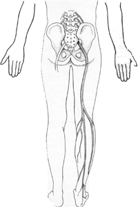 ”sciatic