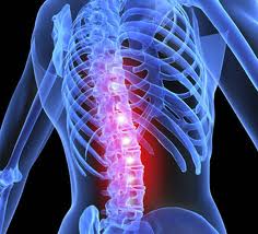 Spine Surgery India