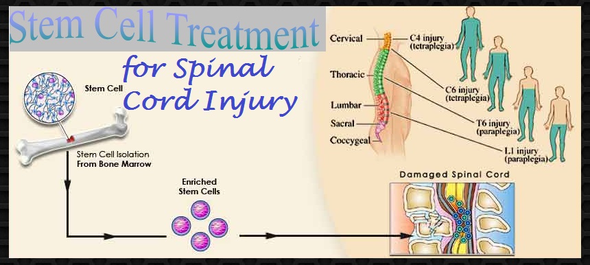 spinal-cord-injury