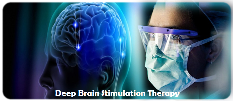 deep-brain-stimulation-therapyy