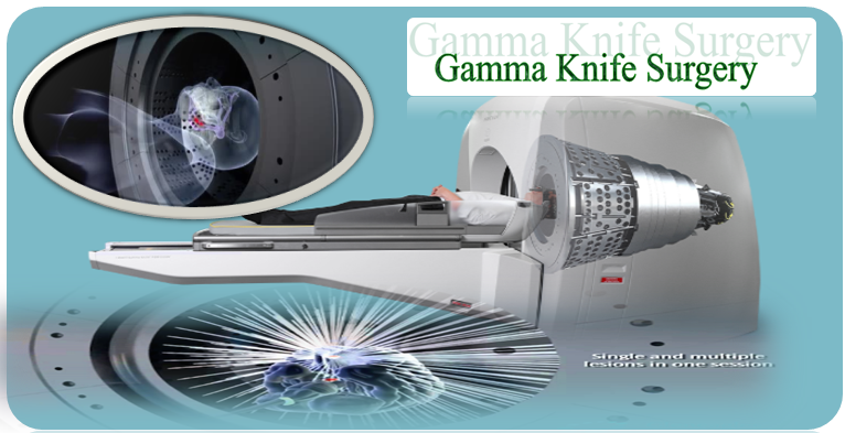 gamma-knife-surgery-in-india