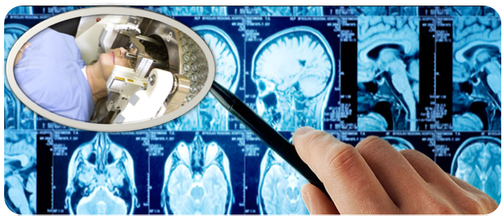 gamma-knife-surgery