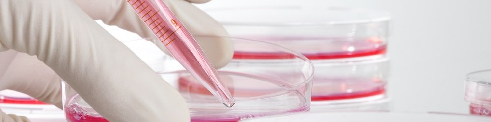 stem-cell-therapy