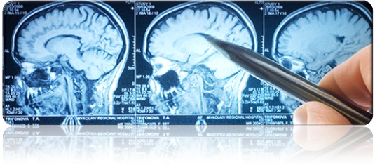 Types of Neurosurgery