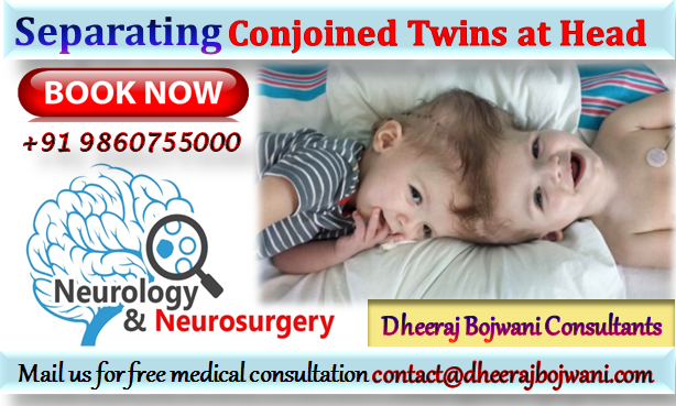 neuro twins head surgery