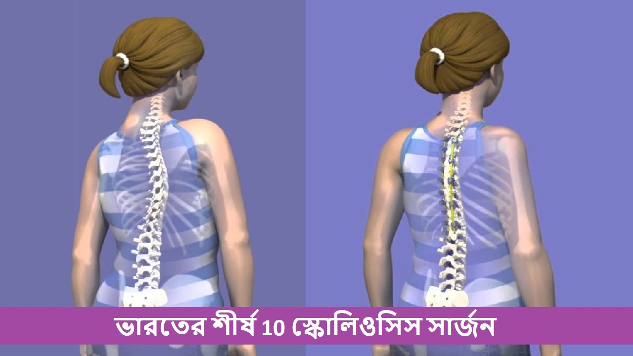 Top Scoliosis Surgeons in India Top 10 Scoliosis Surgeons in India