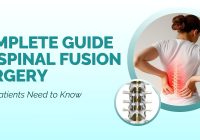 Complete Guide to Spinal Fusion Surgery: What Patients Need to Know